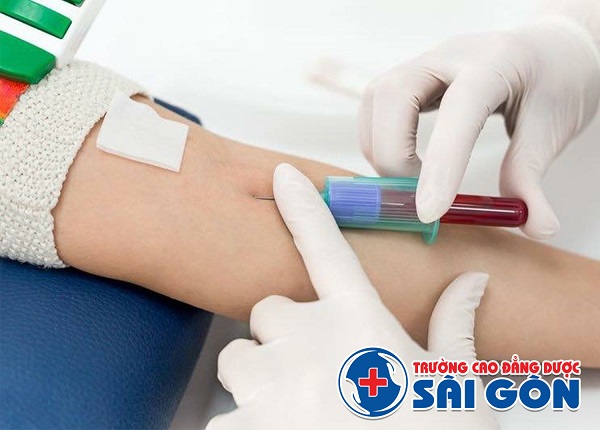 Bài toán nhân lực trong ngành Xét nghiệm Bài toán nhân lực trong ngành Xét nghiệm