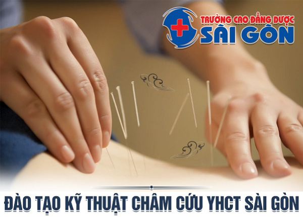 Trường Cao đẳng Dược Sài Gòn đào tạo Kỹ thuật châm cứu YHCT Sài Gòn