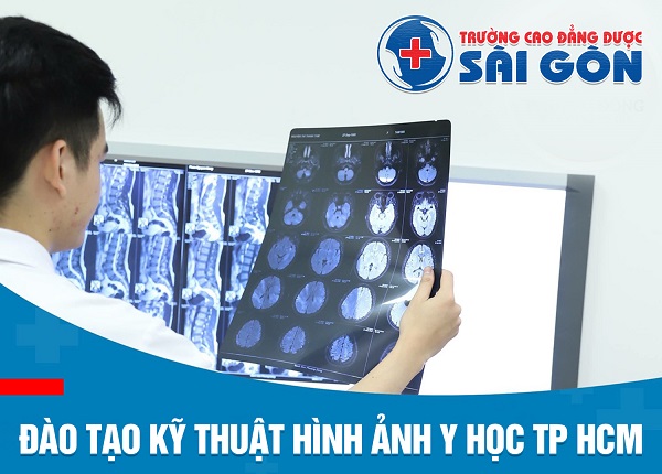 Trường Cao đẳng Dược Sài Gòn đào tạo ngành Kỹ thuật hình ảnh Y học bám sát kỹ thuật công nghệ số 4.0