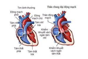 Tìm hiểu thận chung động mạch cùng giảng viên Cao đẳng Dược Sài Gòn