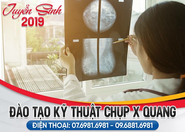 Chụp X Quang để có thể phát hiện ra bệnh giãn phế quản