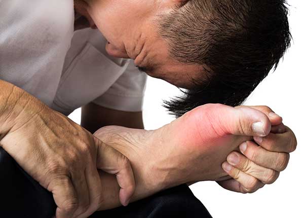 Bệnh gout cấp gây ảnh hưởng không nhỏ đến sinh hoạt của người bệnh