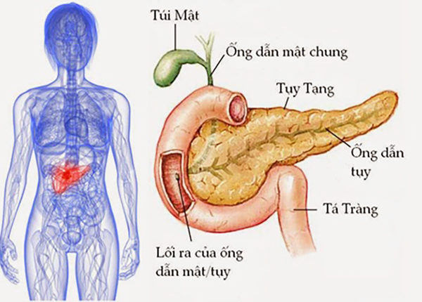 Bệnh viêm tụy dùng để chỉ tình trạng viêm của tụy