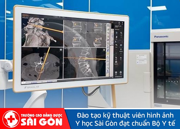 Tìm hiểu phương pháp điều trị dị dạng mạch máu tủy sống cùng với chuyên gia Dược Sài Gòn