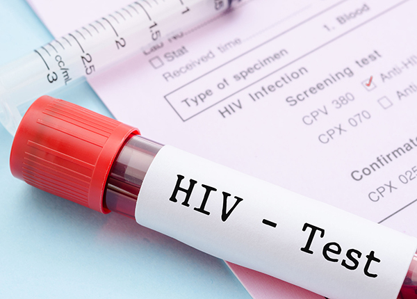 HIV được xem là một căn bệnh thế kỷ, gây nhiều thiệt hại cho cá nhân con người và xã hội