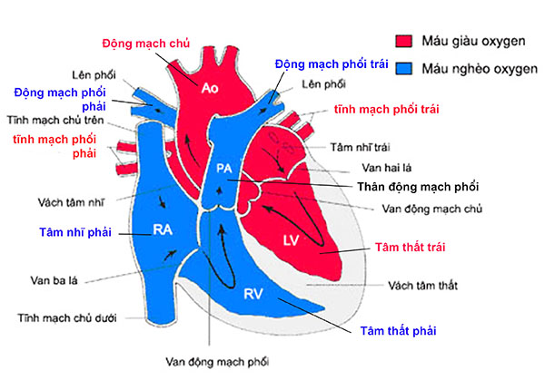 Chuyển vị đại động mạch là một bất thường tim bẩm sinh