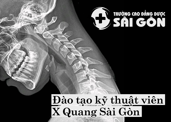 Đào tạo Kỹ thuật viên X Quang Sài Gòn uy tín chất lượng