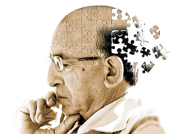 bệnh Alzheimer là một căn bệnh liên quan đến hệ thần kinh