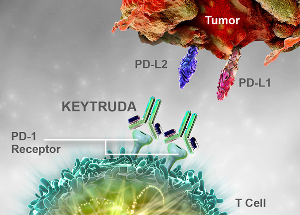 Keytruda là thuốc mới giúp điều trị ung thư dạ dày và thực quản