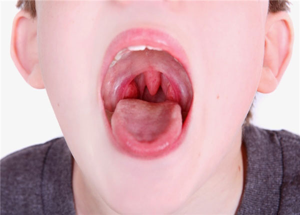 Có nhiều yếu tố gây ra bệnh ung thư vòm họng